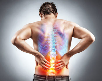 Радикулит как причина боли в спине