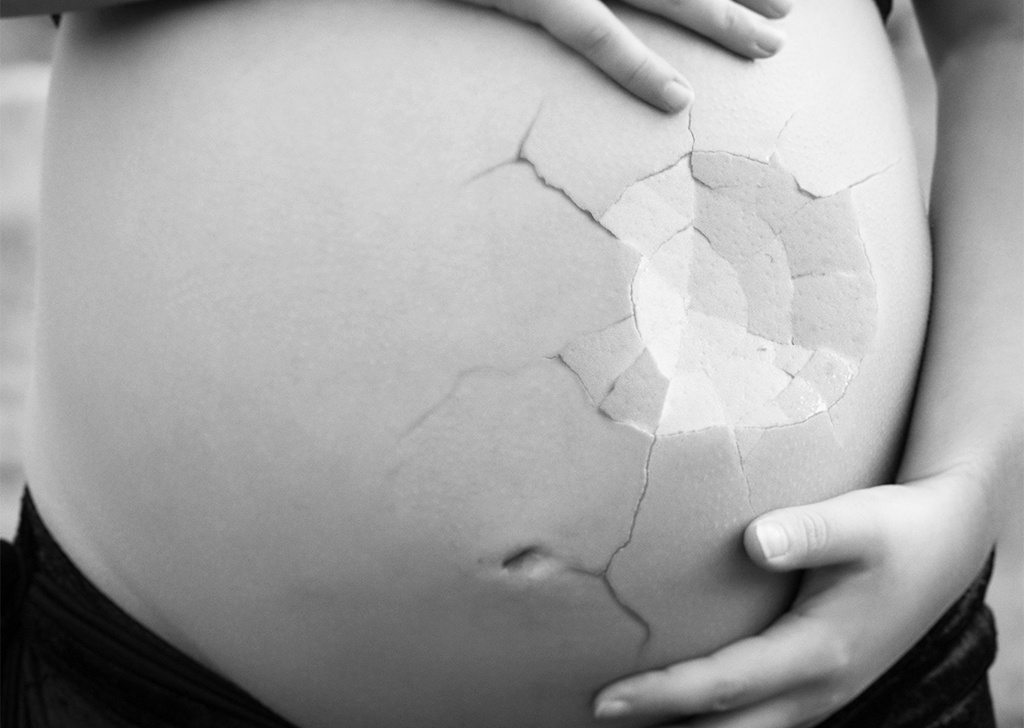 Аборт и его последствия
